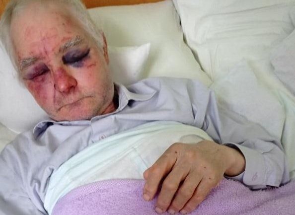 Василий Григорьевич Хащиюк после нападения молодчиков из ПЦУ