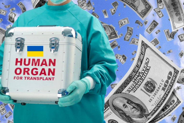 Органы украинцев на продажу